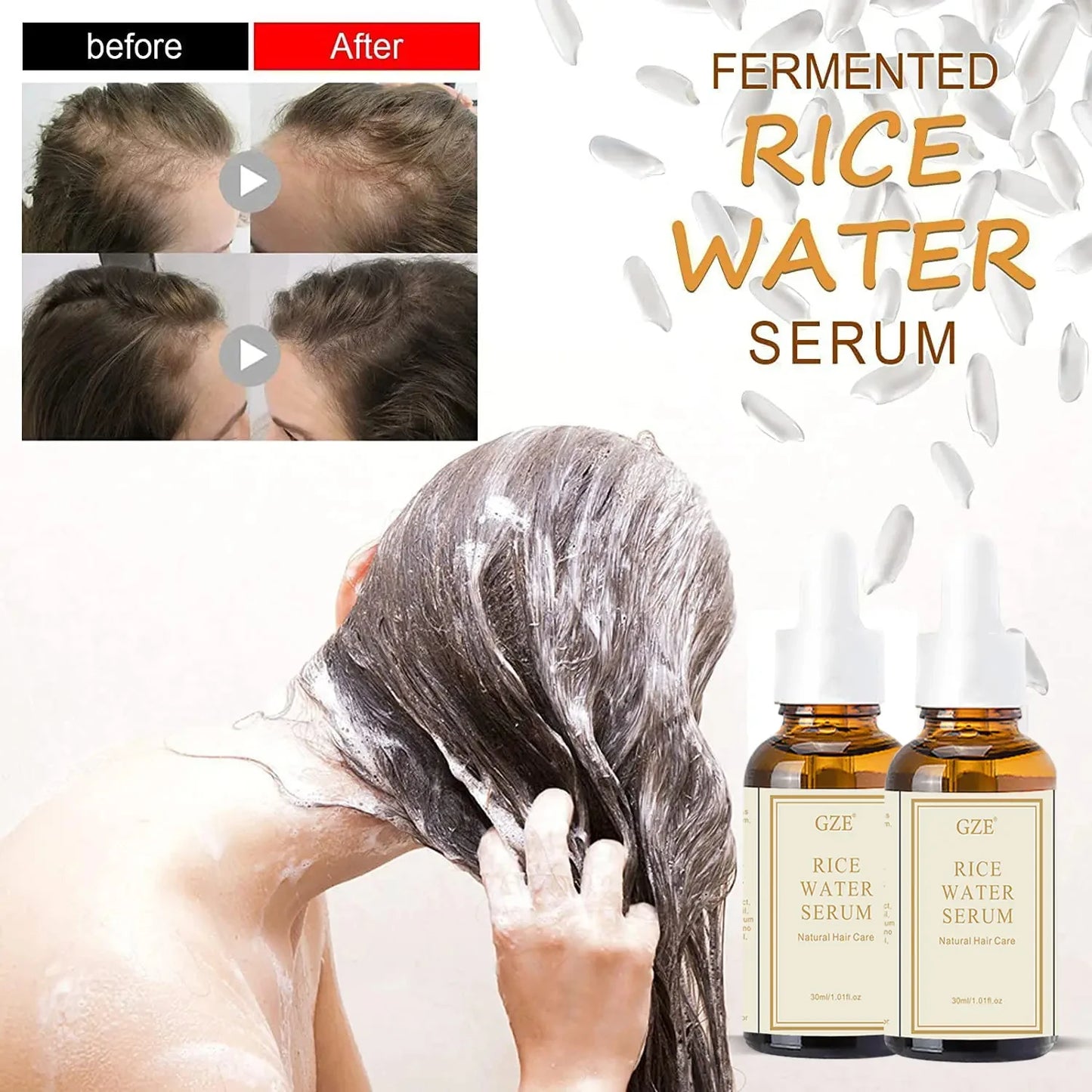 GZE Organic Rice Water Serum for Hair Growth & Skin | 30ml Hair Growth Serum Peaceful Pleasures Health and Wellness