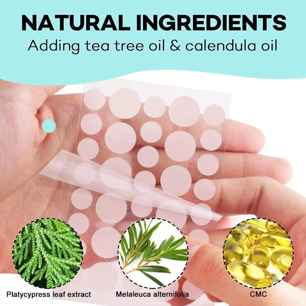 Invisible Pimple Patches with Tea Tree Oil – Hydrocolloid Acne Patches & Blemish Dots (72 or 288 Count) Peaceful Pleasures Health and Wellness