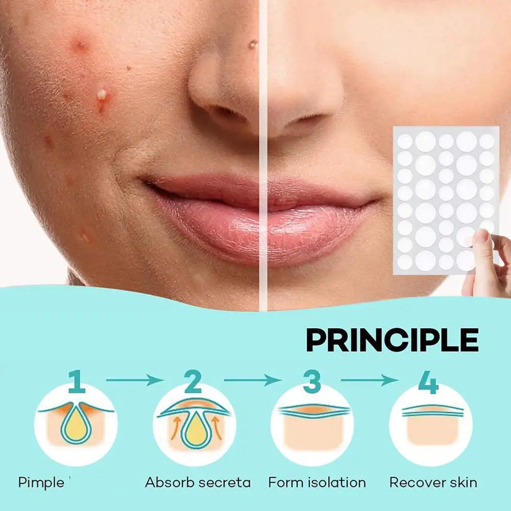 72/288pcs Face Acne Patch Invisible Skin Care Pimple Acne Patches Anti-inflammatory Healing Absorbing Spot Sticker Covering Acne Peaceful Pleasures Health and Wellness