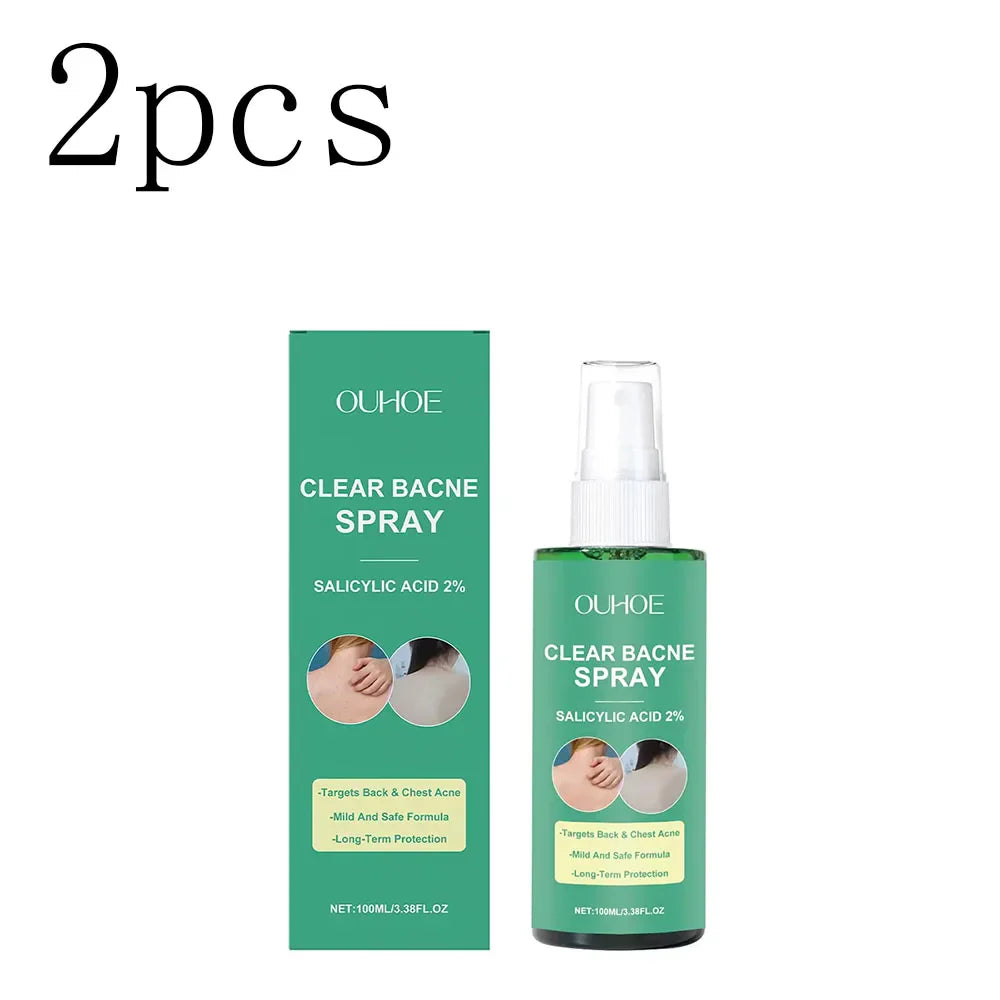 Body Acne Clearing Spray – Oil Control & Moisturizing