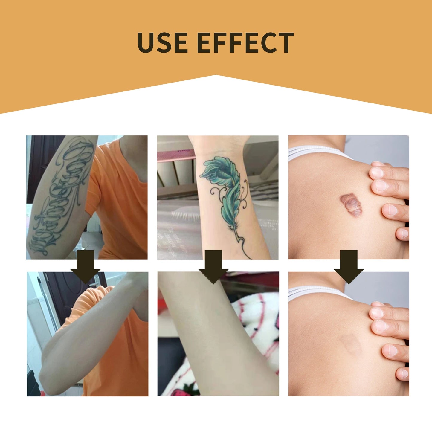Jaysuing 6-Pack Waterproof Concealer Patches – Tattoo & Skin Cover