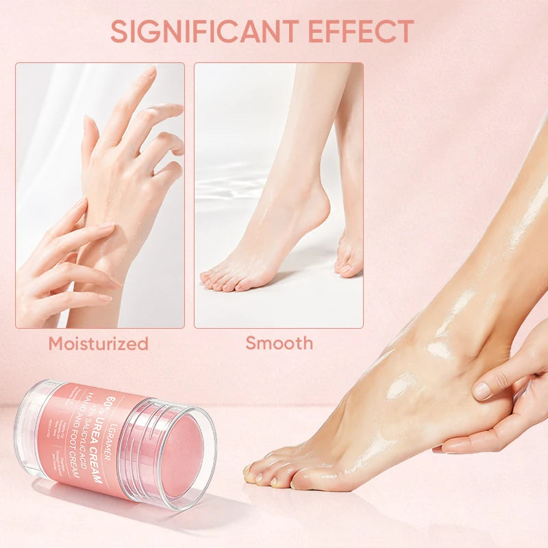 Urea Cream 60 Percent For Feet + 2% Salicylic Acid Exfoliation Foot Cream and Hand Cream Maximum Strength with Hyaluronic Acid Peaceful Pleasures Health and Wellness