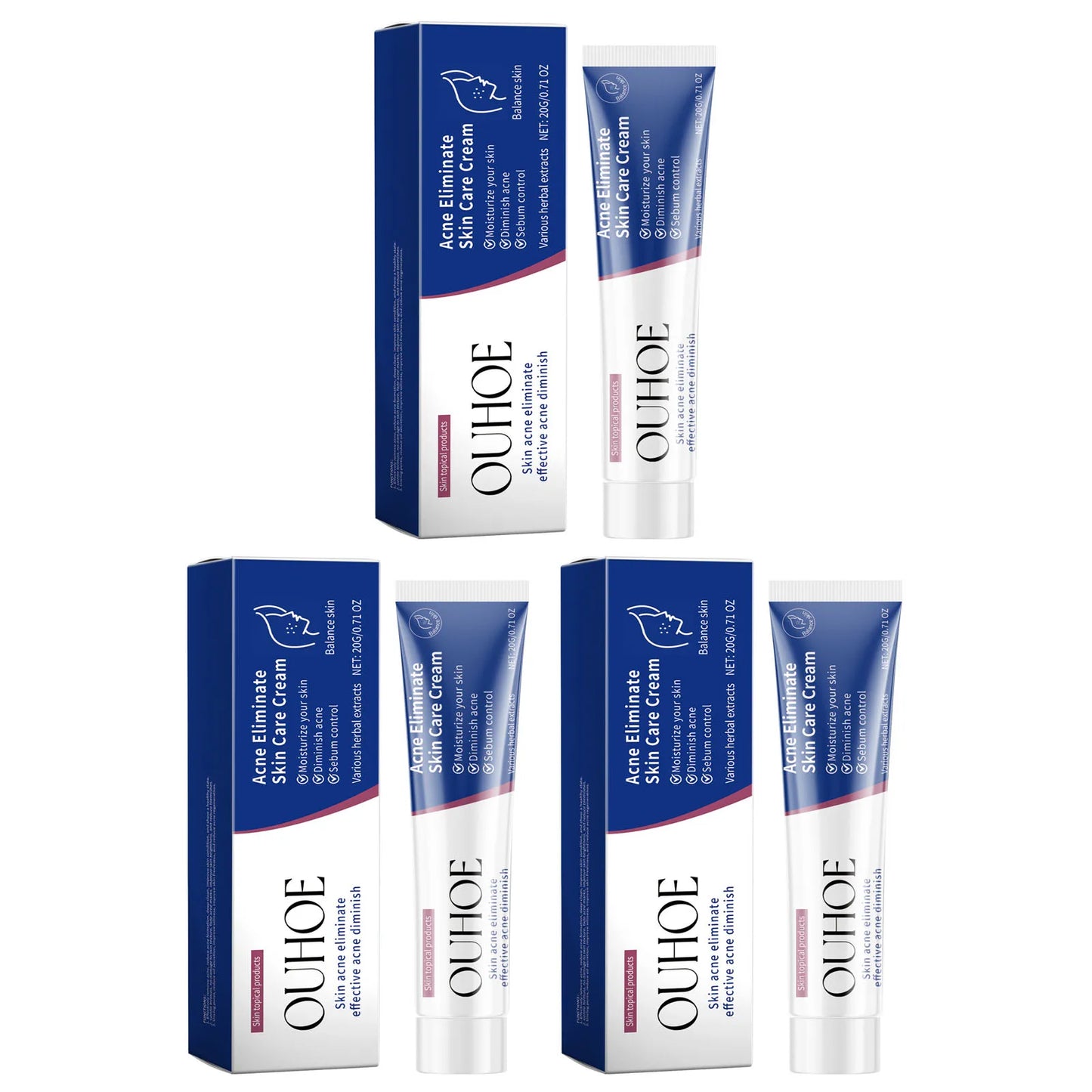 Herbal Acne Face Cream – Oil Control & Blemish Care 20g