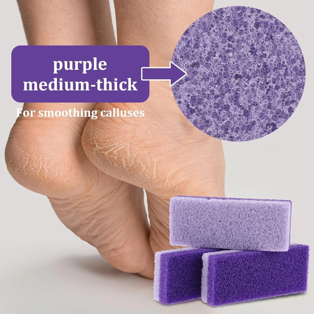 5/10PCS Foot Pumice Stone Foot File Callus Dead Skin Remover Foot Heel Scrubber Smooth Feet In Seconds Pedicure Exfoliator Tool Peaceful Pleasures Health and Wellness
