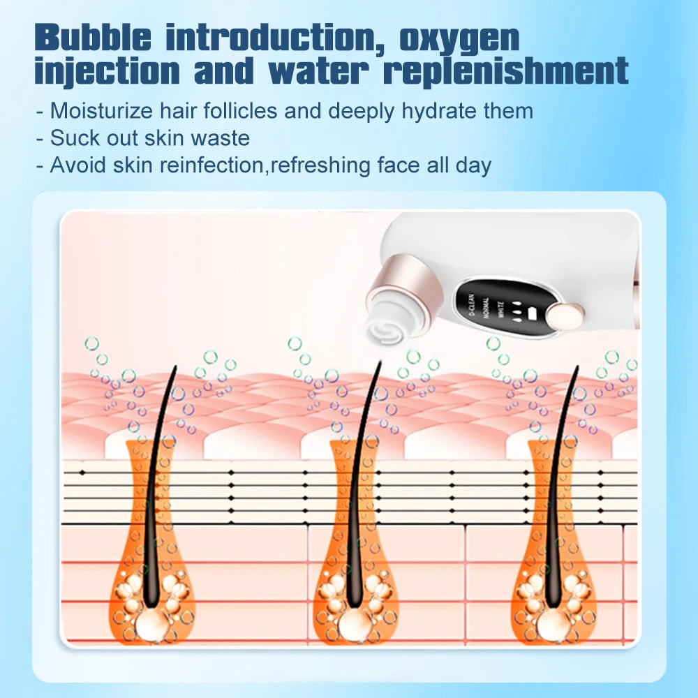 Small Bubble Blackhead Remover Pore Vacuum Face Cleaner Black Head Extractor Skincare Pimple Removal With 6 Suction Heads Peaceful Pleasures Health and Wellness