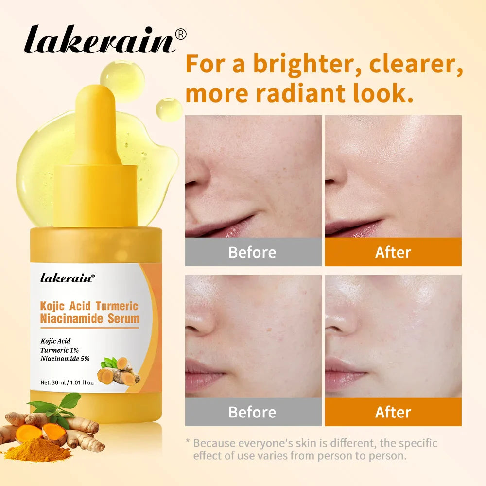 Kojic Acid Turmeric Niacinamide Brightening Glow Serum 30ml Brightening Face Serum Oasis Select