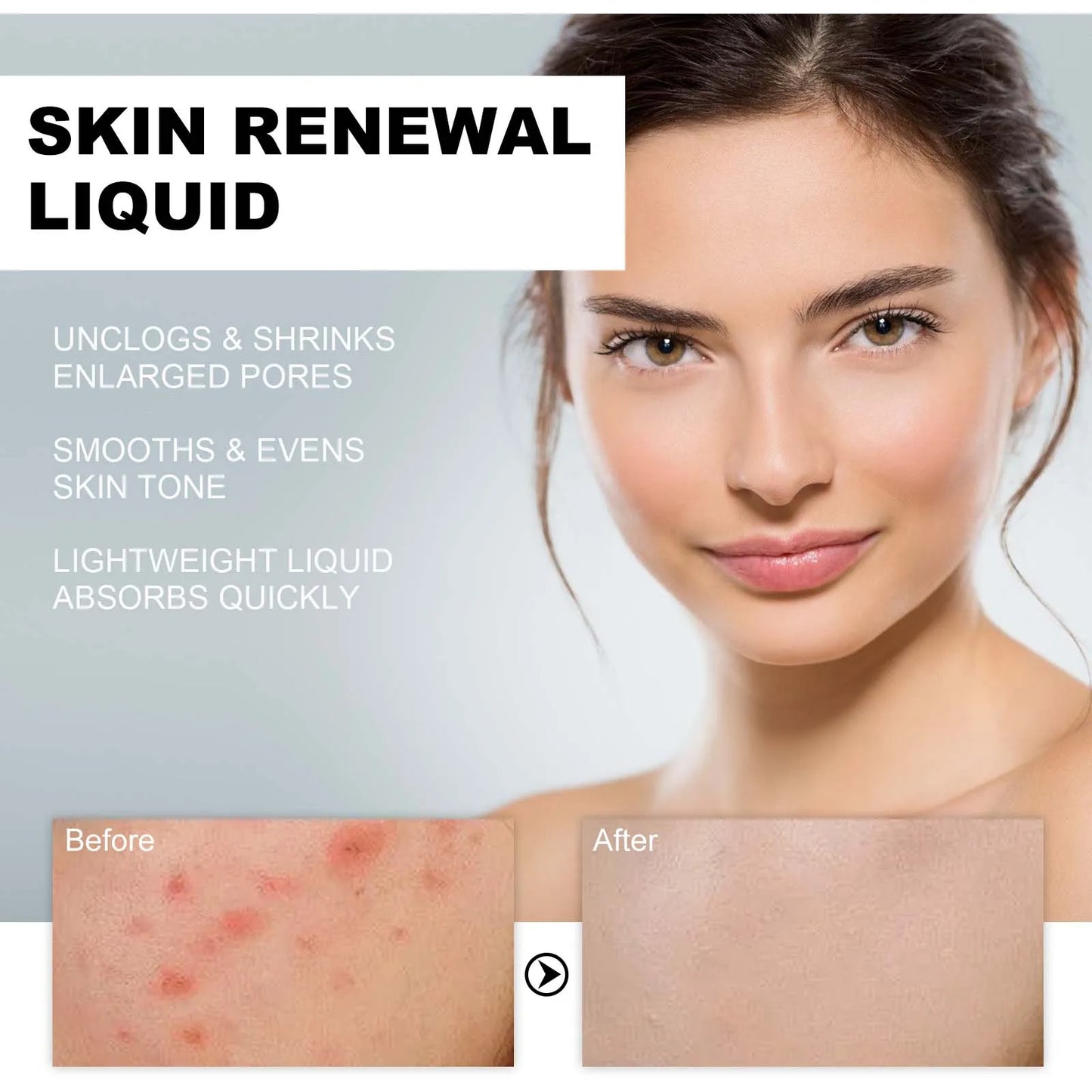 2% BHA Salicylic Acid Serum – Clear Pores & Fade Dark Spots