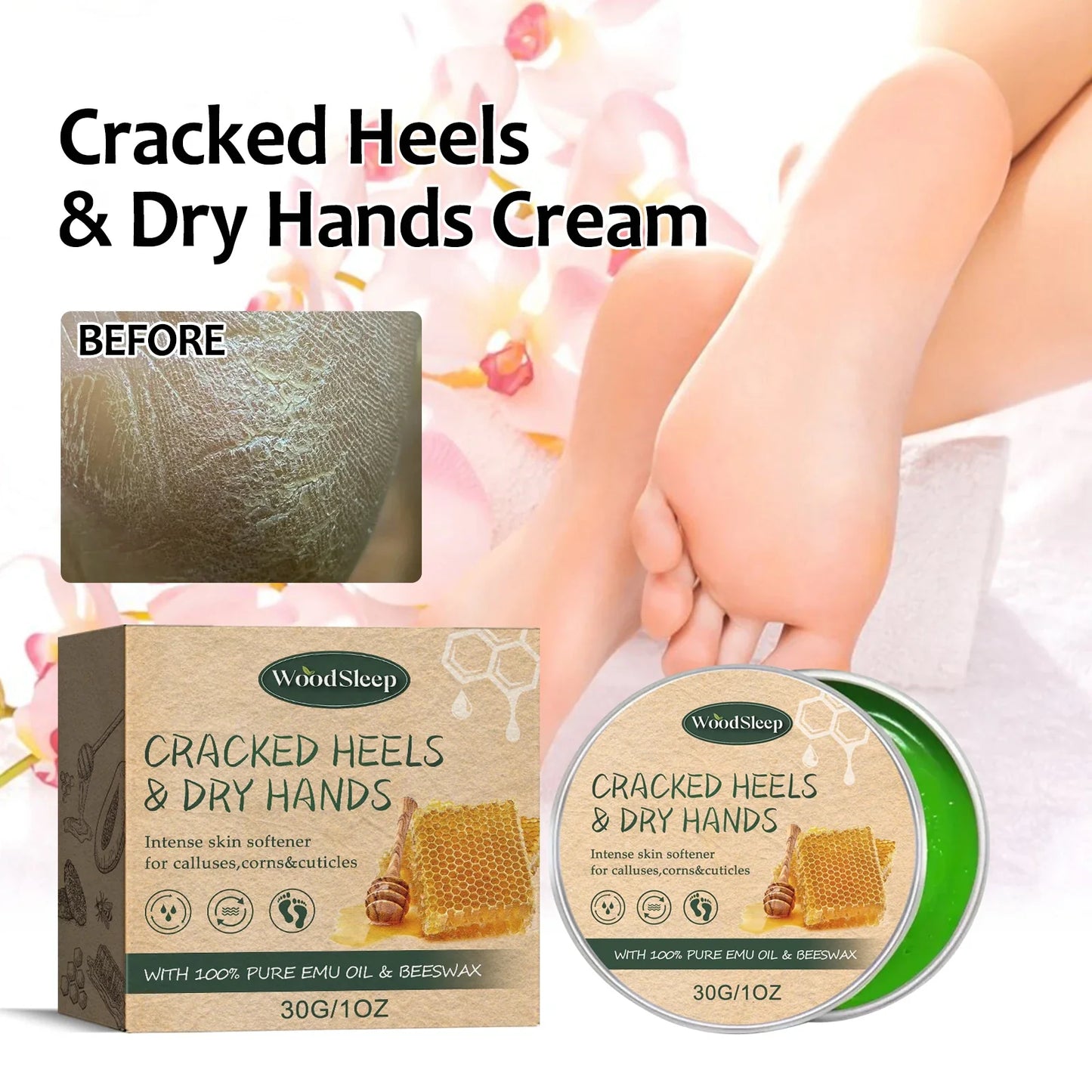 WOODSLEEP Cracked Heel & Hand Repair Cream – Deep Moisturizer
