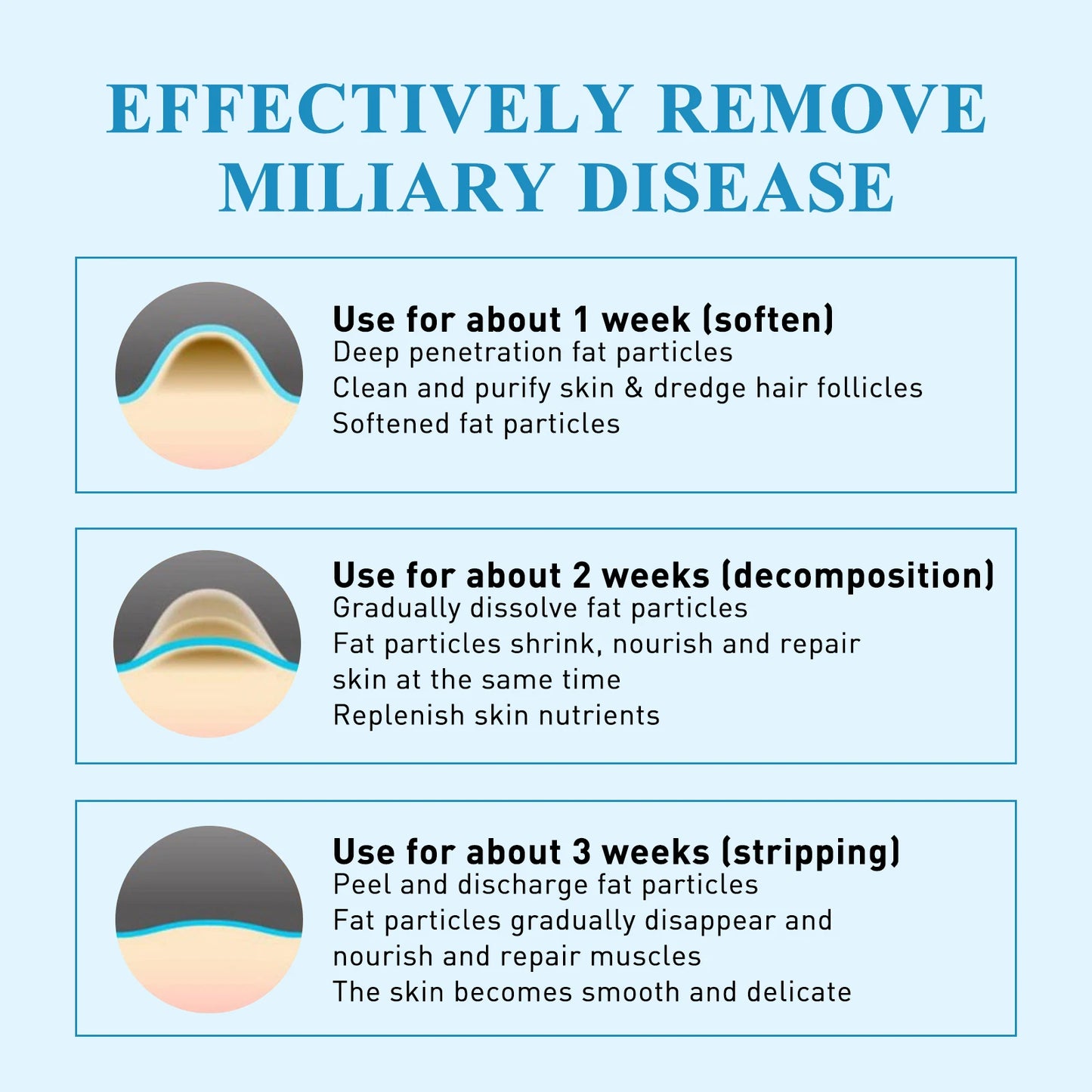 South Moon 144pc Hydrocolloid Blemish Patches | Salicylic & Cica