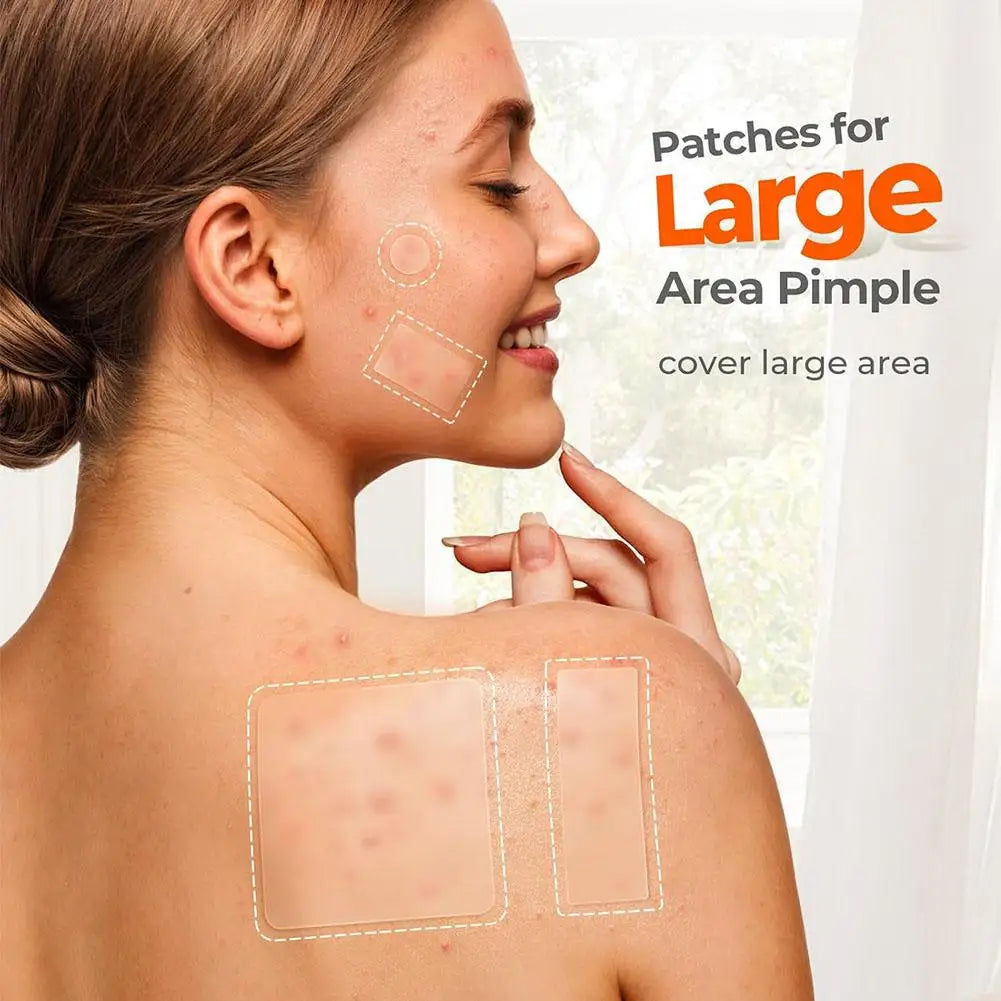 Hydrocolloid Pimple Patches – Mixed Sizes Invisible Acne Spot Stickers for Zits, Spots & Blemishes Peaceful Pleasures Health and Wellness