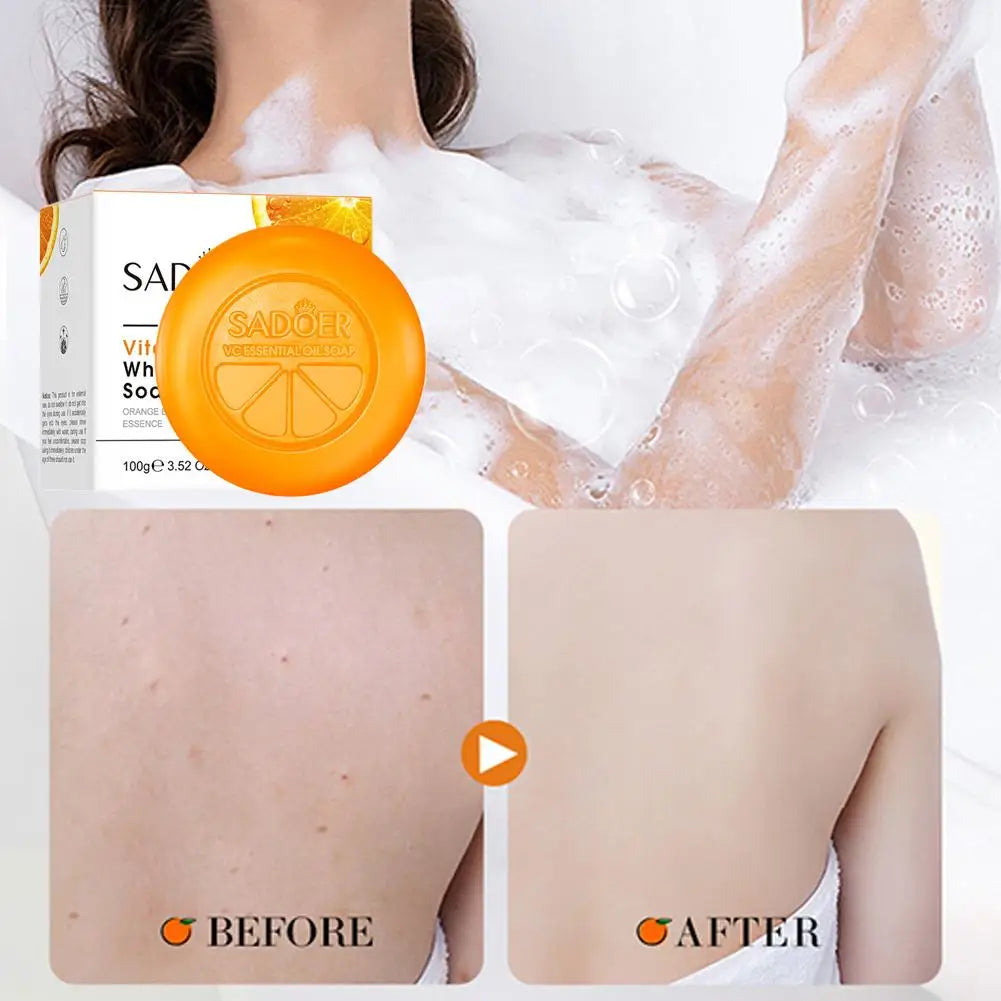 Vitamin C Brightening Soap – Hydrating Face & Body Bar Peaceful Pleasures Health and Wellness