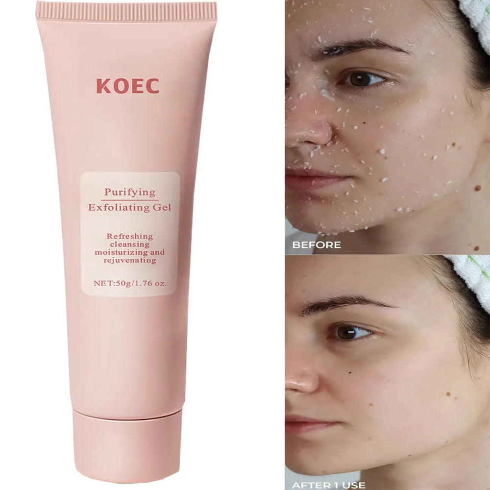 Revitalize Skin Fruit Acid Peeling Gel Facial Cleansing Exfoliating Peeling Scrub Deep Clean Acne Blackhead Remove Face Cleanser Peaceful Pleasures Health and Wellness Default Title