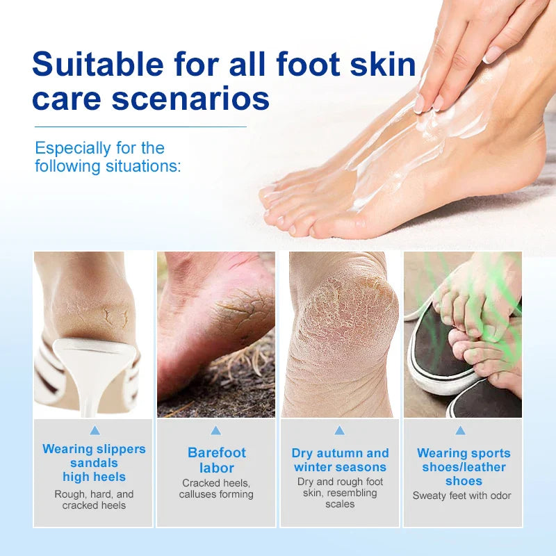 JoyPrettyin 42% Urea Foot Cream – Exfoliating & Moisturizing