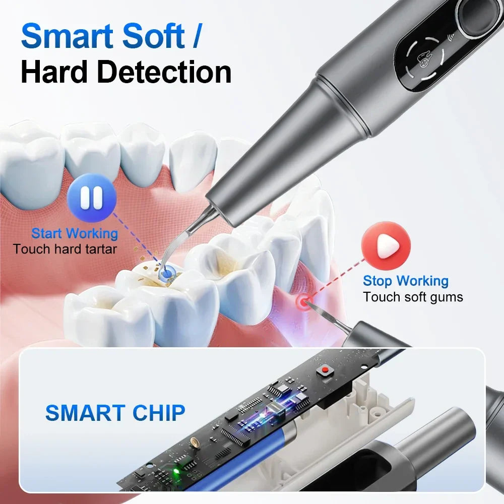 M1 Ultrasonic Teeth Cleaner – HD Camera, 5 Modes & UV Light