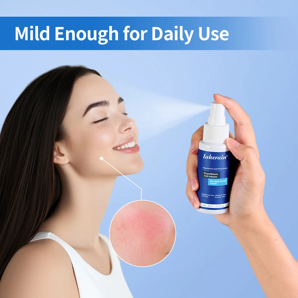 Hypochlorous Acid Facial Spray Reduce Redness Breakouts Soothing For Daily Facial Rescue Calm Redness Skin Care Products Peaceful Pleasures Health and Wellness