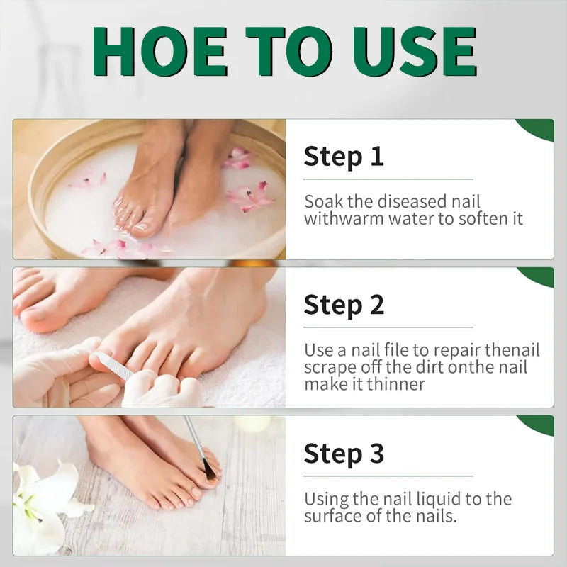 Eelhoe Nail Repair Serum – Ginger Extract for Healthy Nails