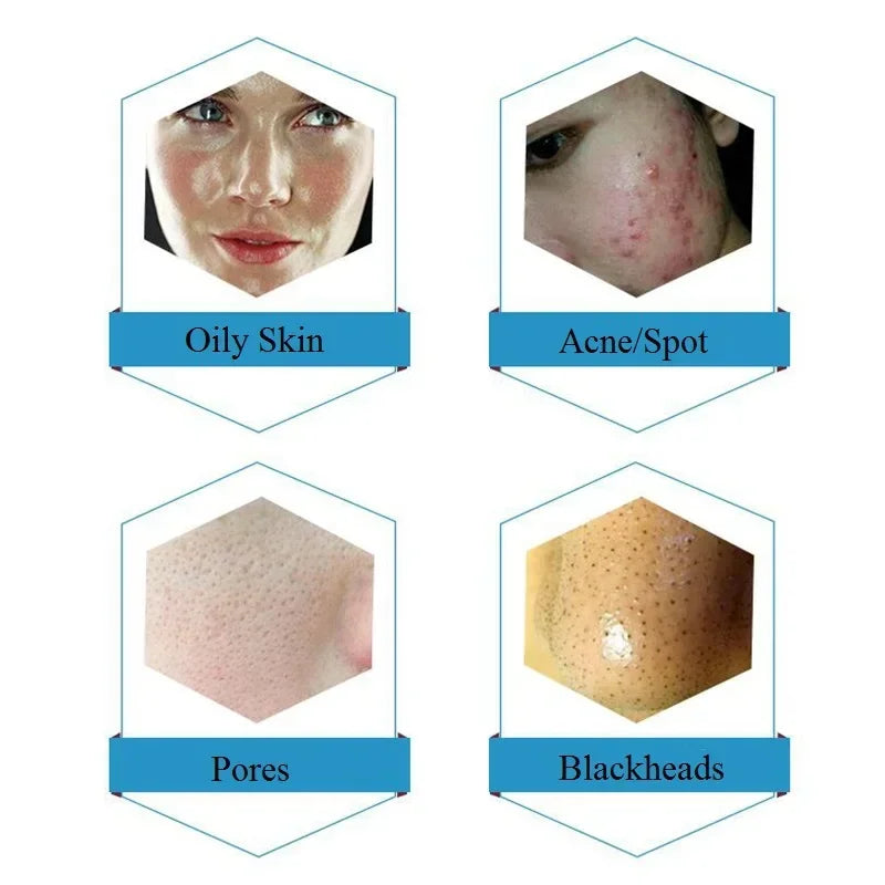 Dermabrasion Facial Serum 50ml | Hydrating Deep Cleansing Exfoliant