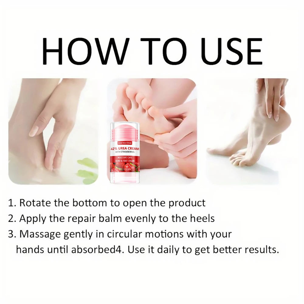 Urea Strawberry Hand & Foot Cream – Hydrates & Heals Dry Skin