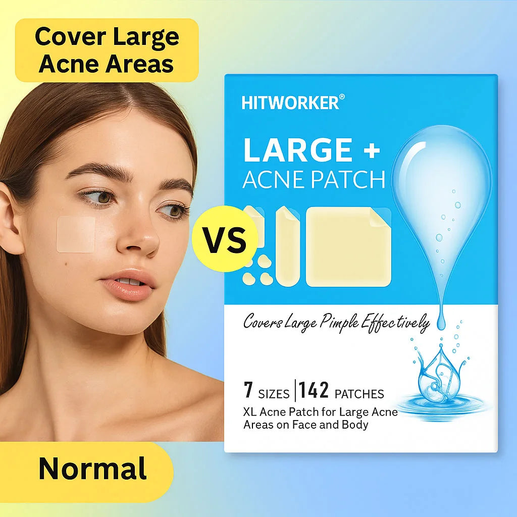 Hydrocolloid Acne Patches – Invisible & Waterproof | All Skin Types