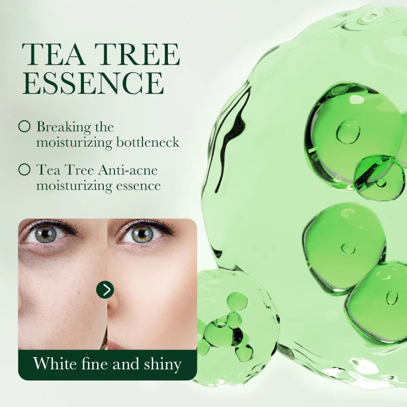 SADOER Tea Tree Acne Face Cream – Oil Control & Moisturizer
