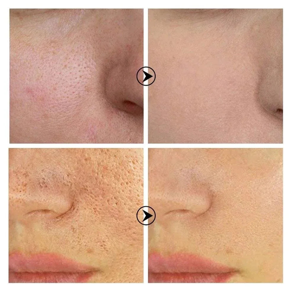 Pore Refining Facial Serum with Retinol & Niacinamide – 10mL