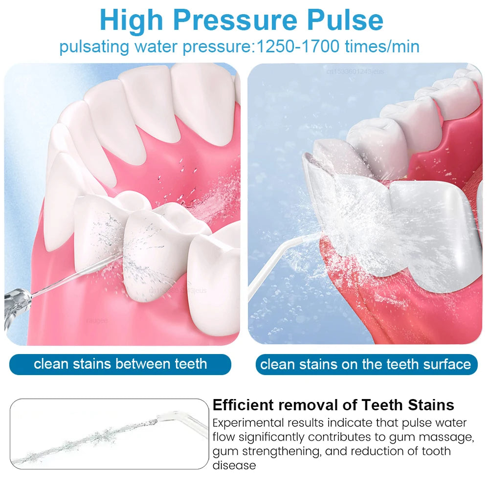 Oral Irrigator Dental Water Flosser for Teeth High Pressure Electric Dental Irrigator Water Flosser Mouth Washing Machine 800ML Peaceful Pleasures Health and Wellness