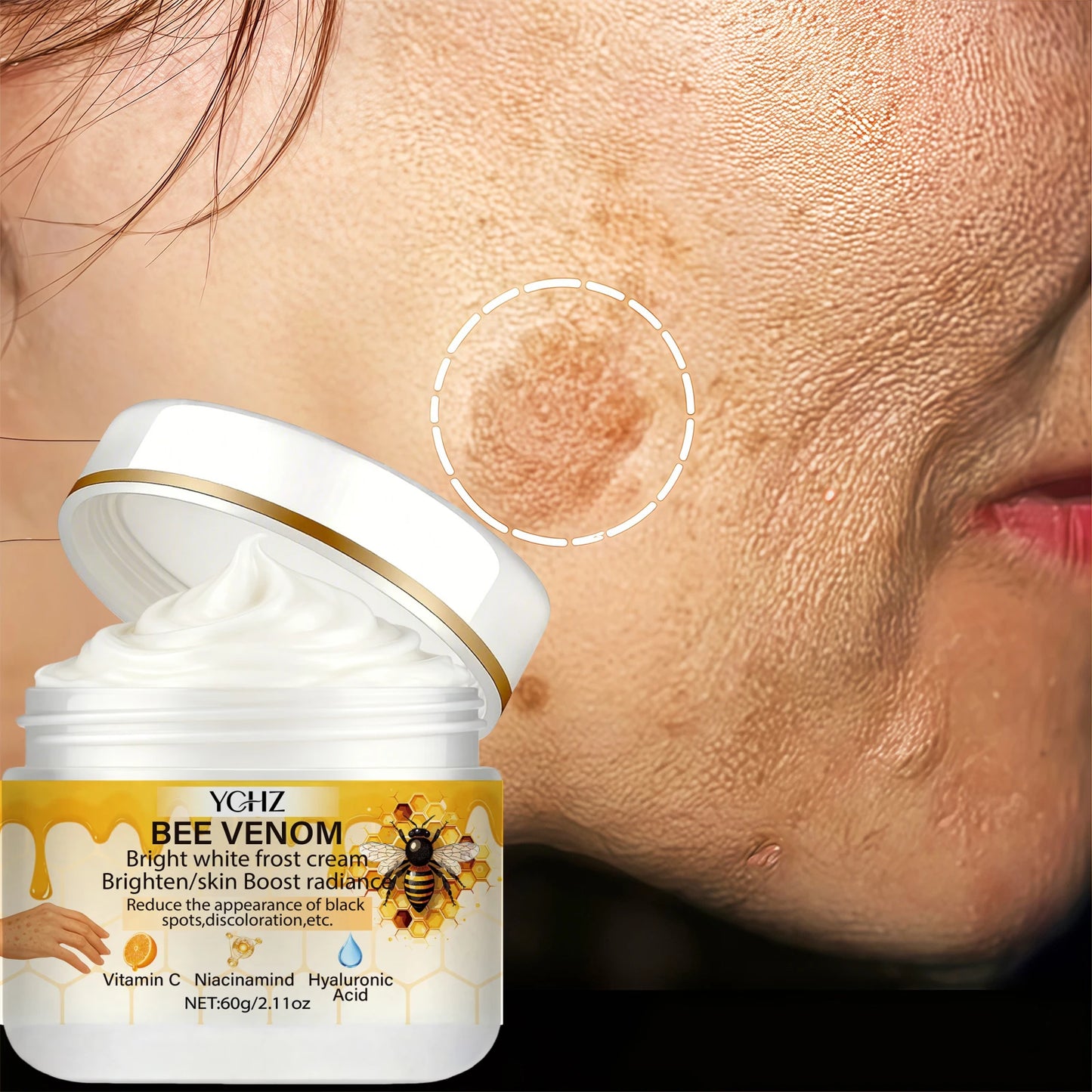 YCHZ Bee Venom Brightening Cream – Even Skin Tone | 60g