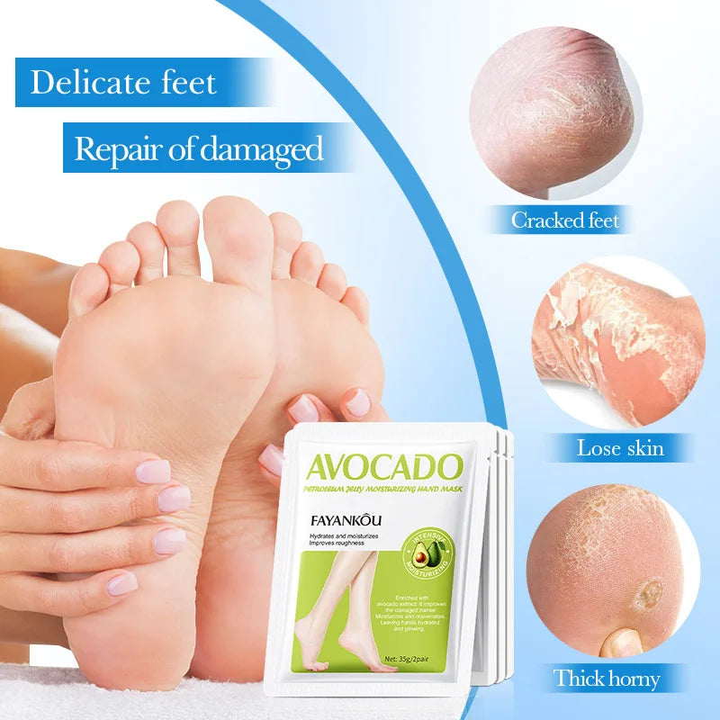 BIOAOUA Avocado Exfoliating Foot Mask 5 Pairs – Dead Skin Remover