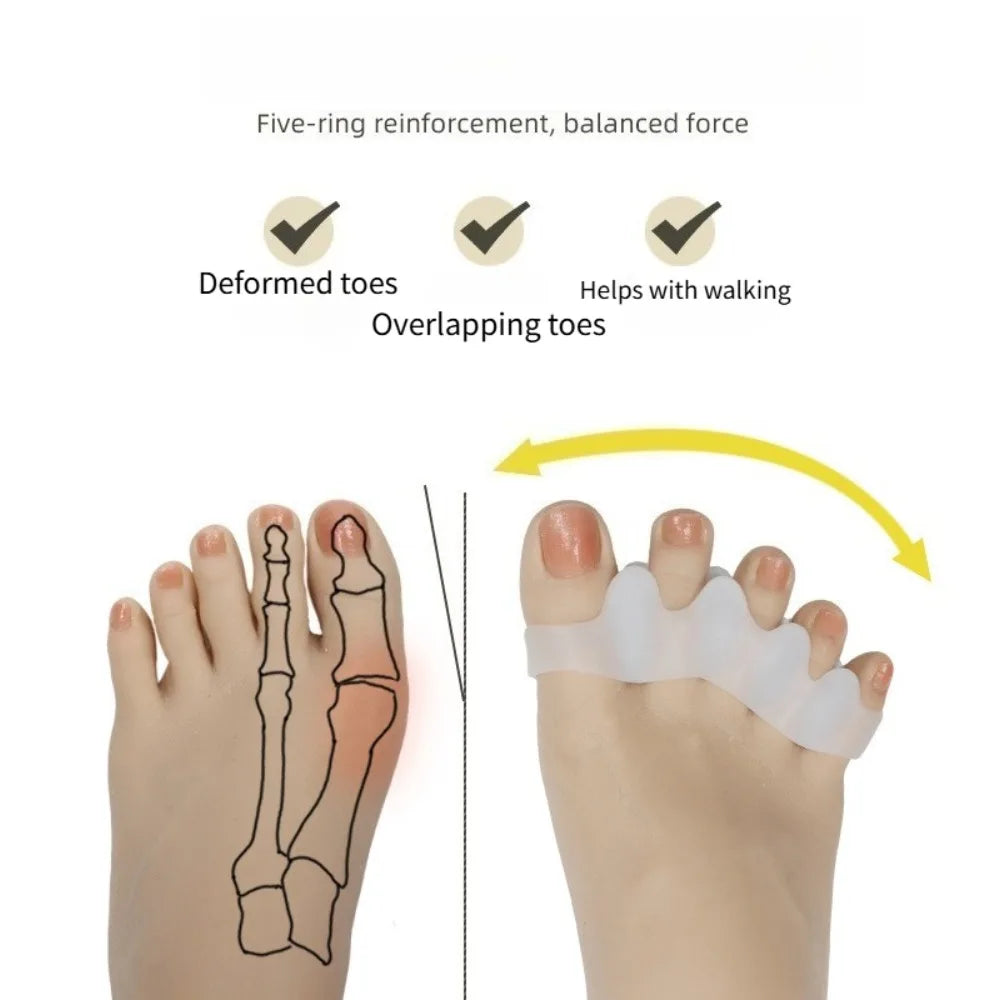 2pcs=1pair Protective Toes Separator Suitable Bunion Corrector Material Soft Gel Straightener Spacers Care Tool Small Easy Carry Peaceful Pleasures Health and Wellness