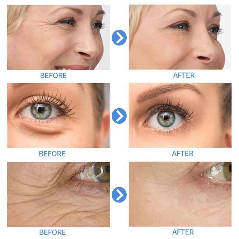 Sakura Eye Bag Repair Serum Roller Massage Cream Anti-Wrinkle Firming Skin Fine Lines Anti Dark Circles Puffiness Brighten Eye Peaceful Pleasures Health and Wellness