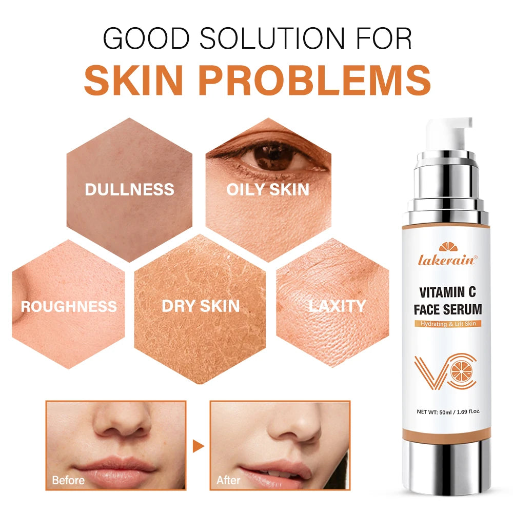 Vitamin C Face Serum Mild Ingredients Moisturizing Restoring Skin Elasticity Refreshing And Comfortable Facial Skin Care Essence Peaceful Pleasures Health and Wellness