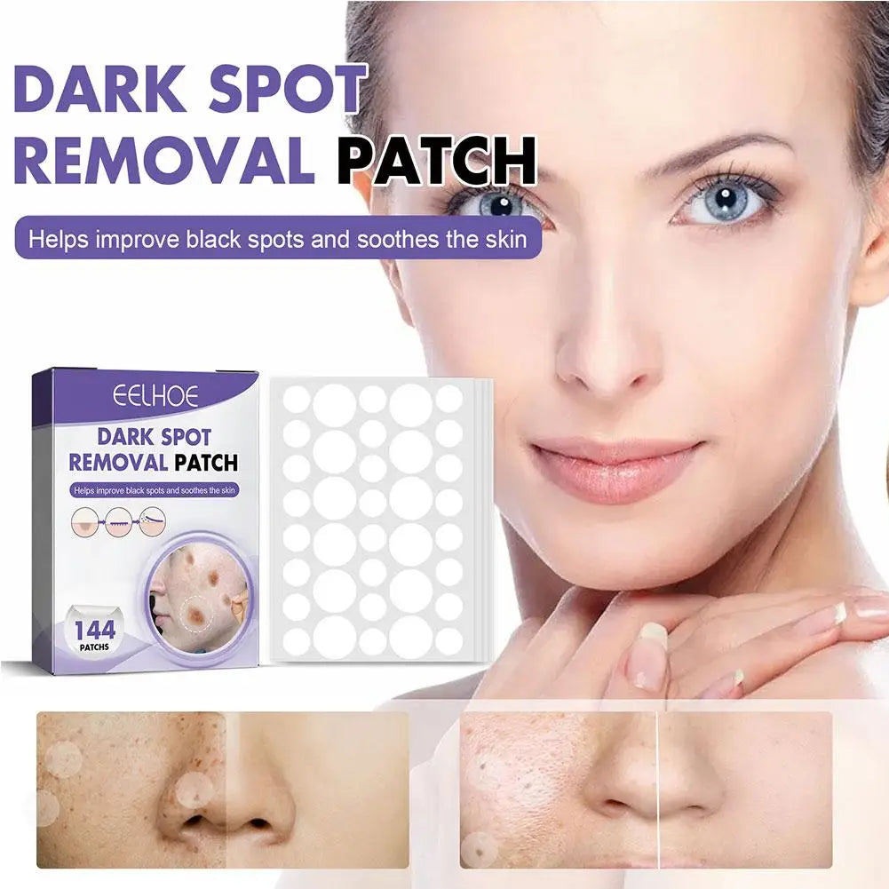 144-Pack Star Pimple Patches – Invisible Acne Spot Stickers
