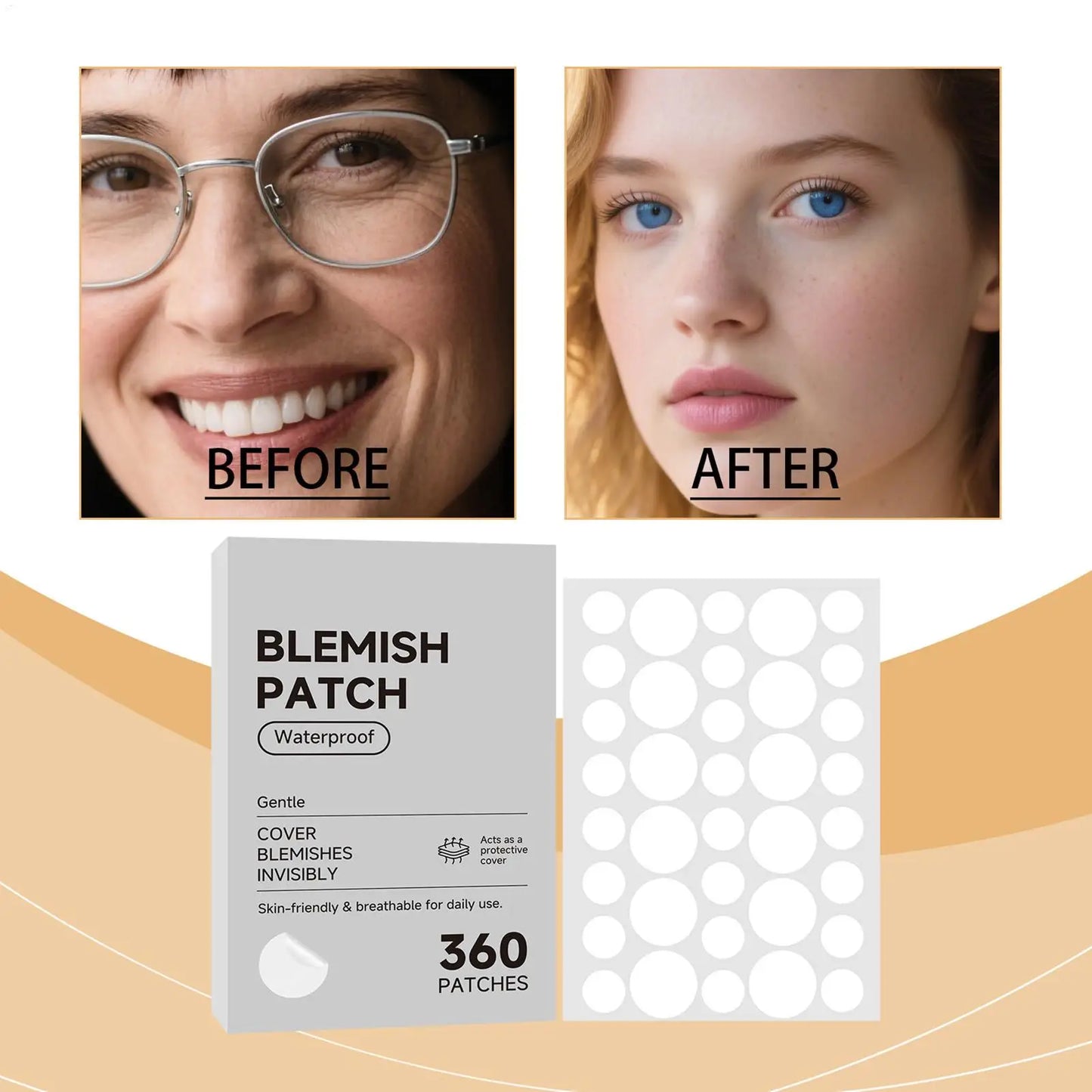 Hydrocolloid Acne Patches 360ct – Waterproof Blemish Spot Dots
