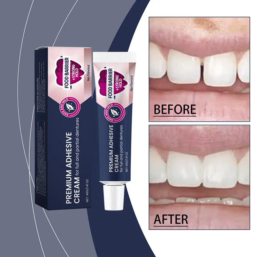 Denture Fixing Adhesive Cream Strong Complete Professional Dentures Glue Dentistry Products Materials Strong adhesion Peaceful Pleasures Health and Wellness