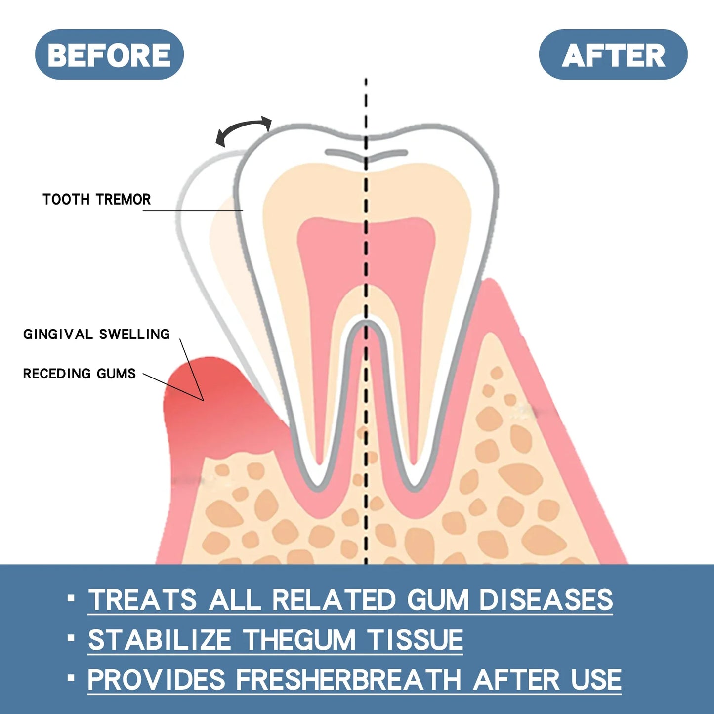 Gum Protect Repair Drops | Gum & Teeth Brightening Serum 30ml