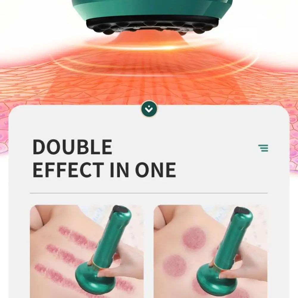 Rechargeable Cupping Massager – 12-Level Suction & Heat
