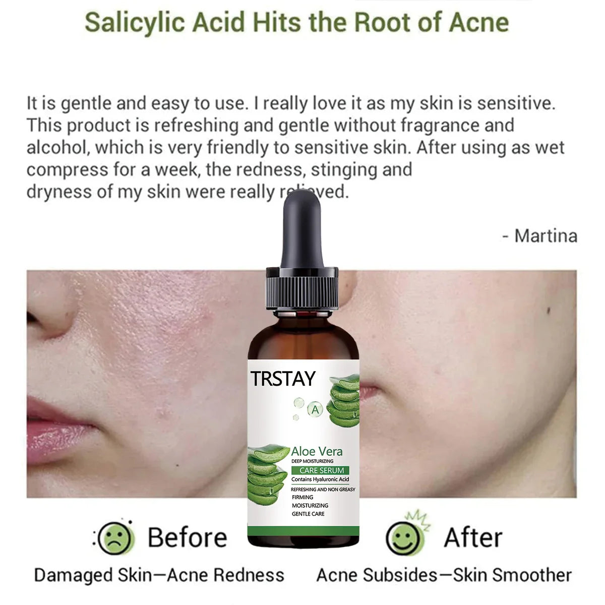 Aloe Vera Vitamin E Face Serum – Brighten & Hydrate Skin