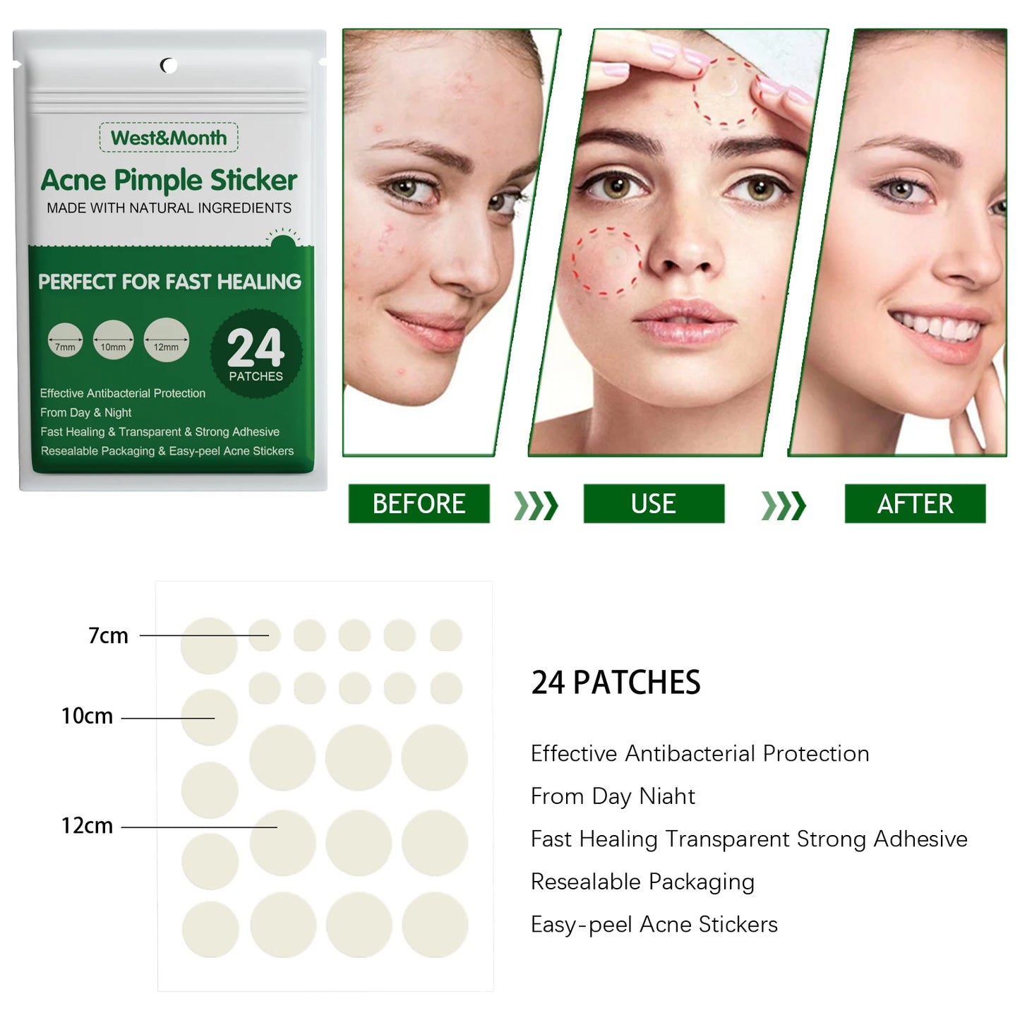 24PCS Hydrocolloid Acne Patches – Salicylic Acid & Glycerin