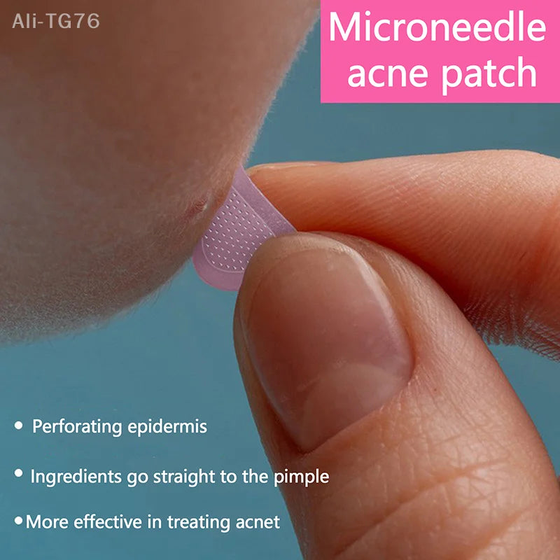 Salicylic Acid Microneedle Acne Patches | Blemish Treatment