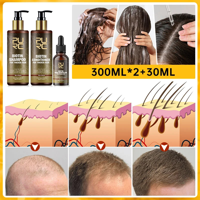 Biotin Prevent Hair Loss Shampoo And Conditioner Growth Oil Treatment For Hair Fast Regrowth Care Beard Hair Beauty Health Care Peaceful Pleasures Health and Wellness