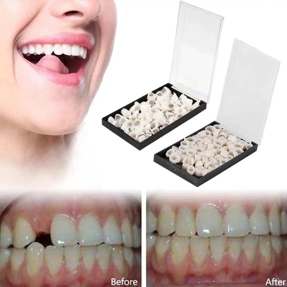Temporary Dental Crowns | Anterior & Posterior Teeth Set Temporary Dental Crowns Peaceful Pleasures Health and Wellness