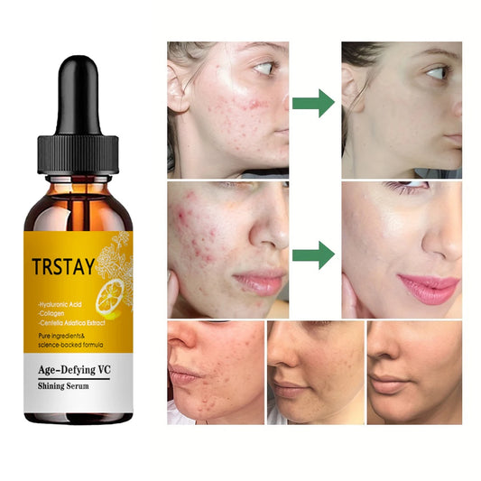 Vitamin C Serum Face Glowing Dark Spot Remover Skincare Moisturizer Wrinkle Remove Anti Aging Facial Serum Korean Cosmetics Peaceful Pleasures Health and Wellness 15ML