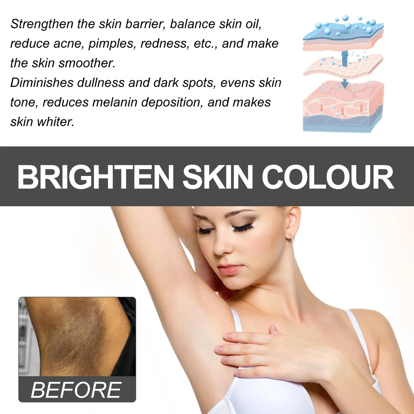 Brightening Skin Cream – Dark Spots, Underarms & Thighs