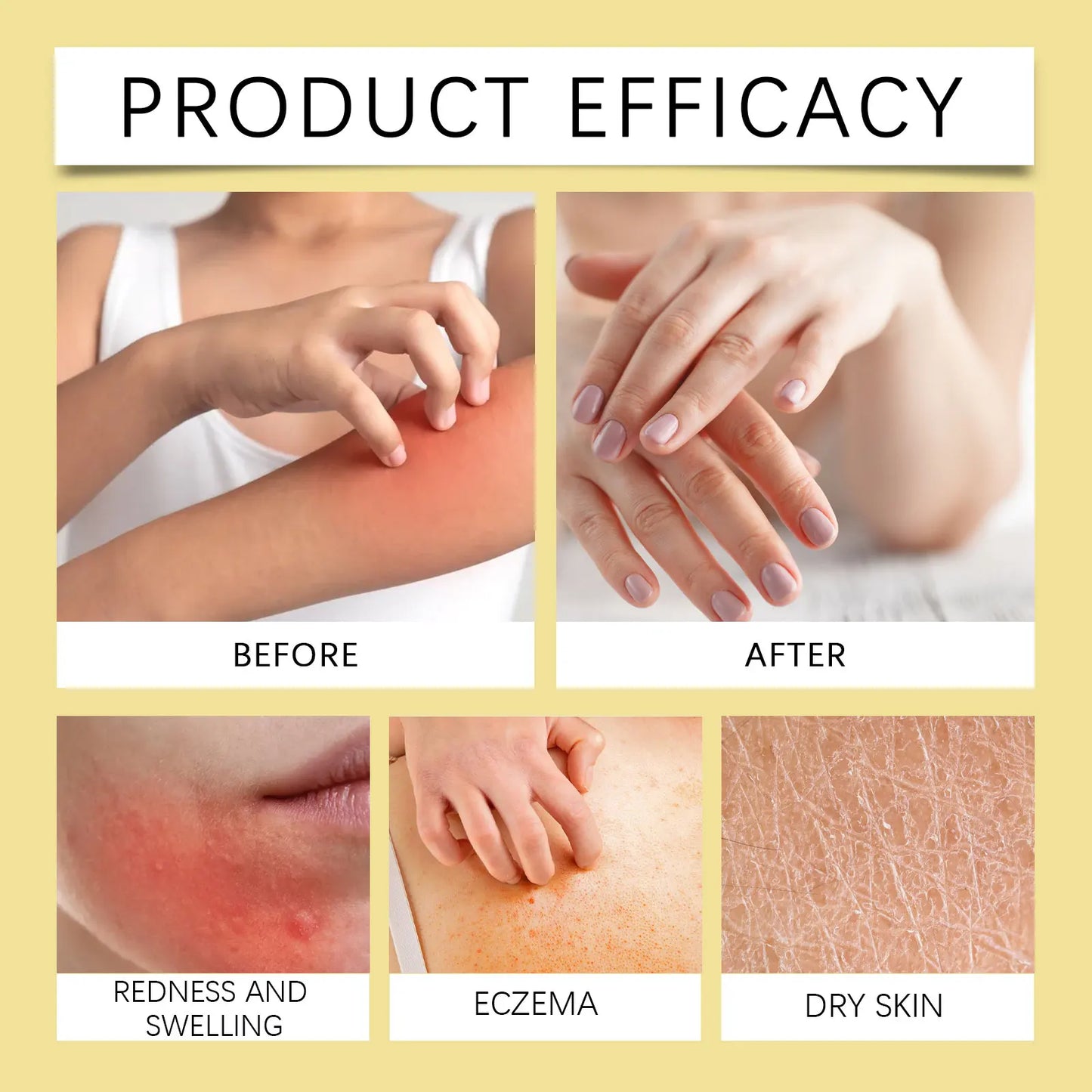 OceAura Rosa Extract Body Oil | Rosehip Moisturizing Dry Skin Oil
