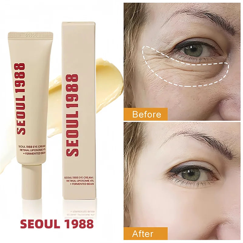 SEOUL 1988 4% Retinol Eye Cream – Firming & Brightening 30ml