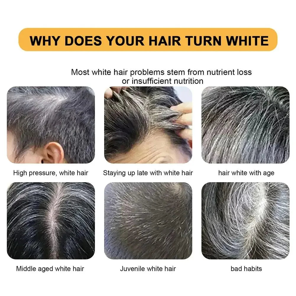 1/3pcs Polygonum Multiflorum Black Hair Soap White Hair Repair Soap Hair Care Nourishing Anti Dandruff Natural Hair Dye Soap Peaceful Pleasures Health and Wellness