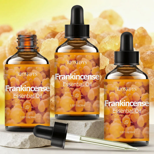 Frankincense Essential Oil – Massage, Hair Care & Diffuser Essential Oil Oasis Select