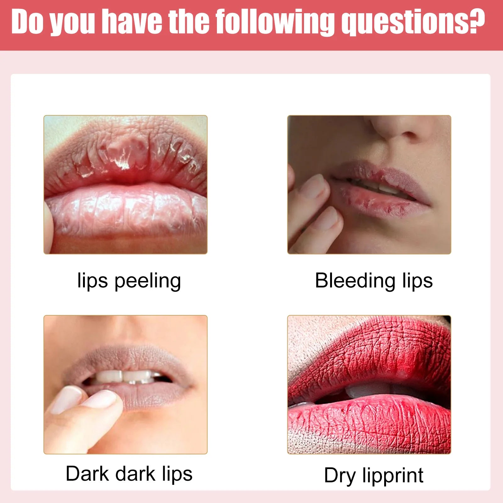 Eelhoe Lip Brightening Balm – Dark Pigment & Moisture Cream 30g Lip Brightening Balm Peaceful Pleasures Health and Wellness
