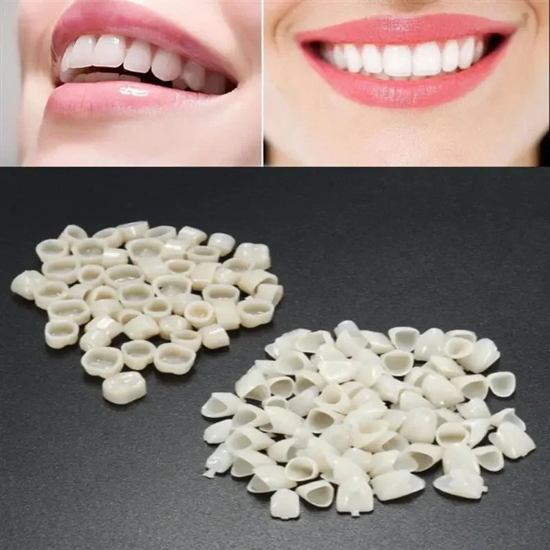 60pcs Resin Teeth Dentistry Dental Temporary Crown Material for Anterior & Molar Teeth Protecting Oral Care Whitening Stable Peaceful Pleasures Health and Wellness