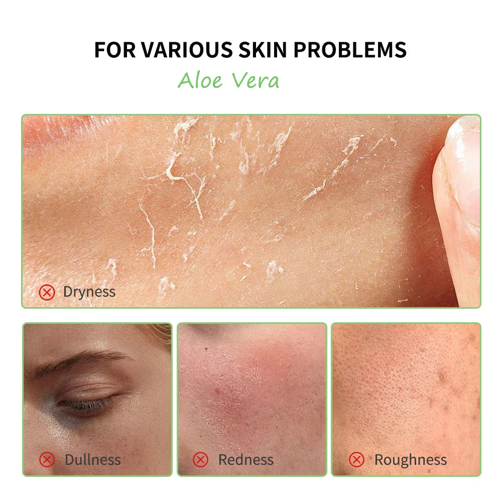 Lakerain Organic Aloe Vera Gel – Hydrating & Brightening